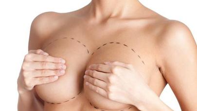 Kimlər sinə əməliyyatı etdirə bilər?